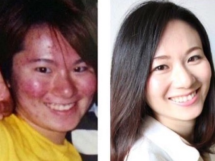 美容家永松麻美