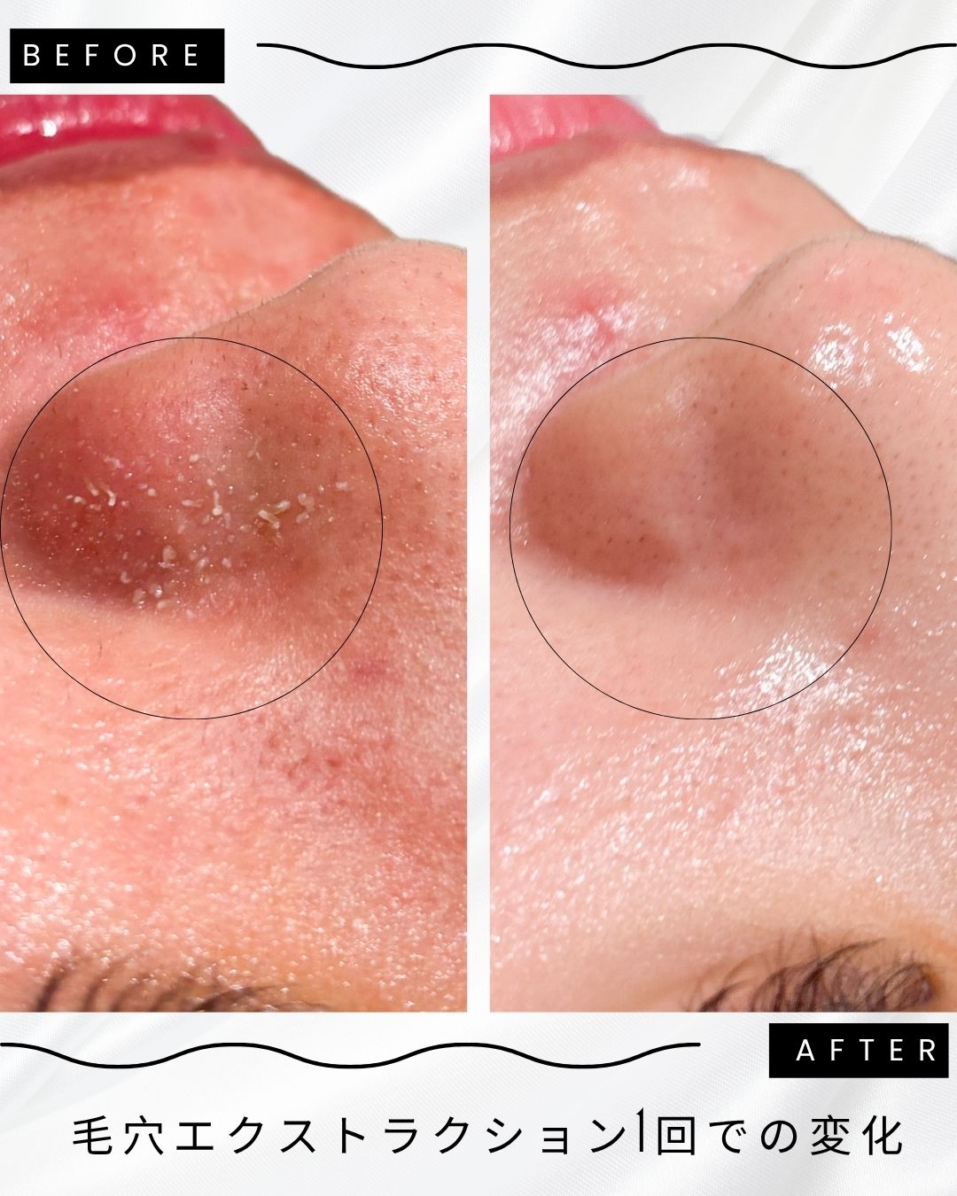 エクストラクション下北沢