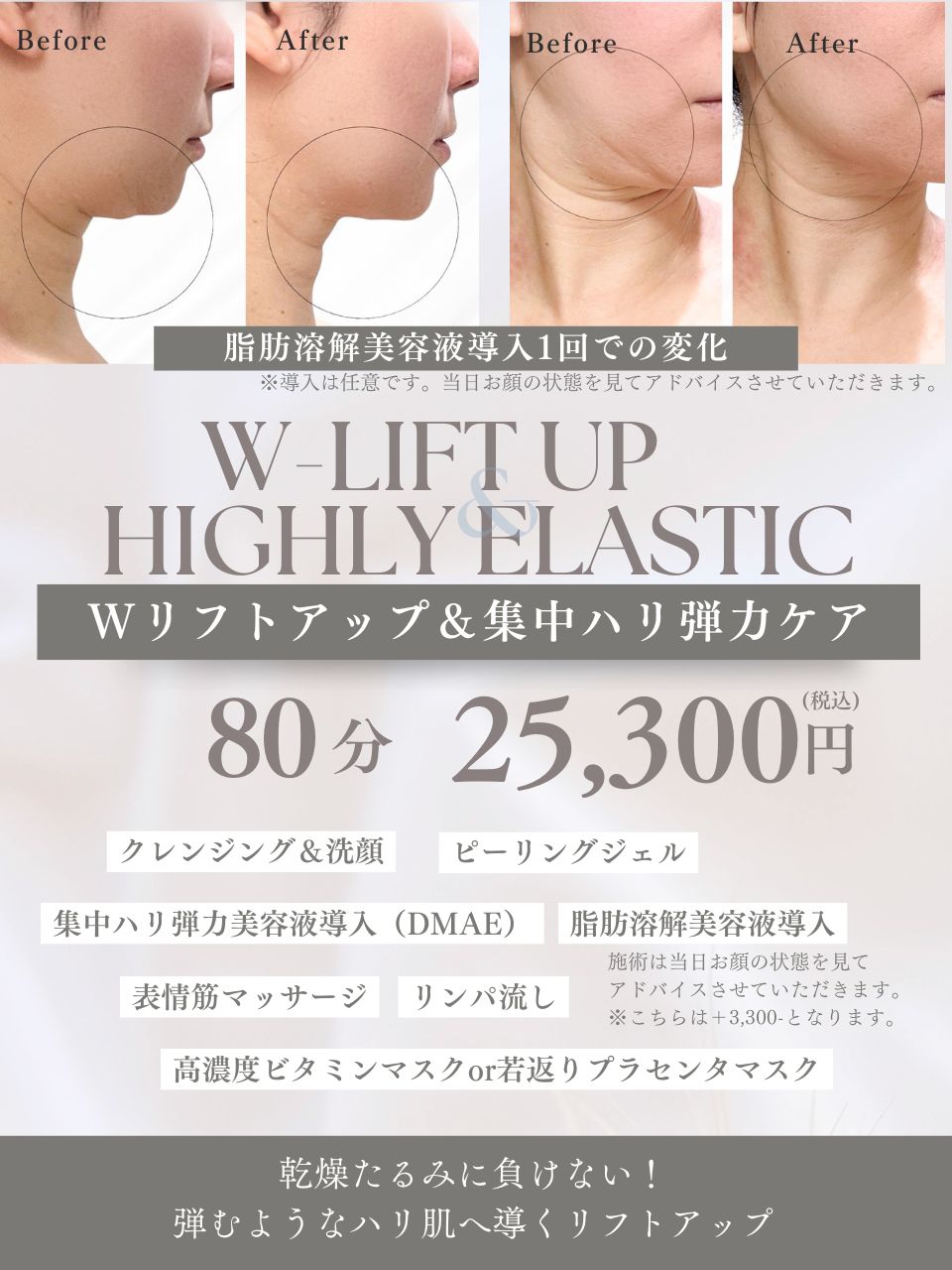 下北沢 リフトアップ