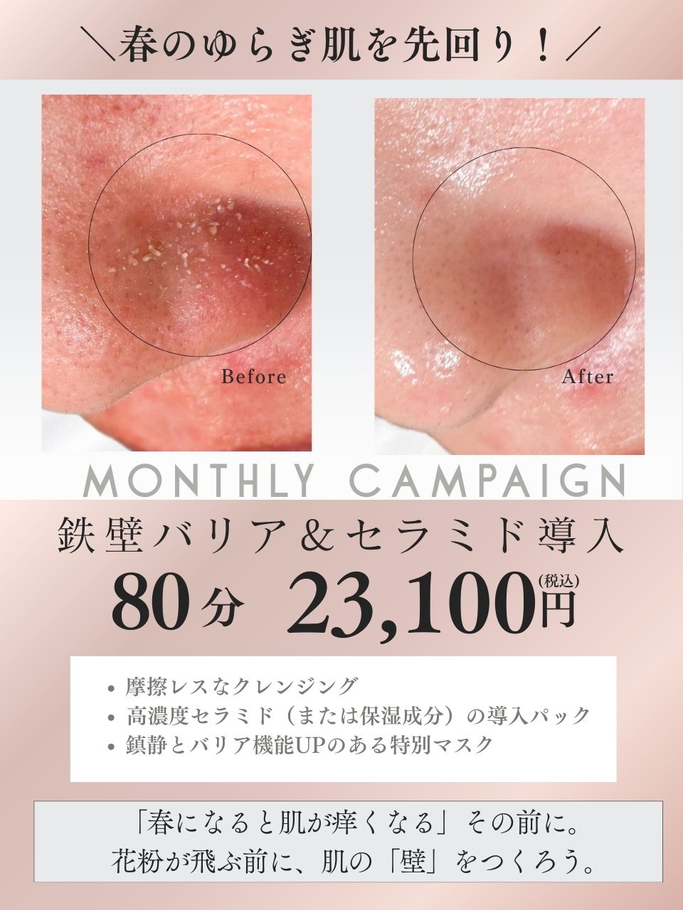 下北沢フェイシャル