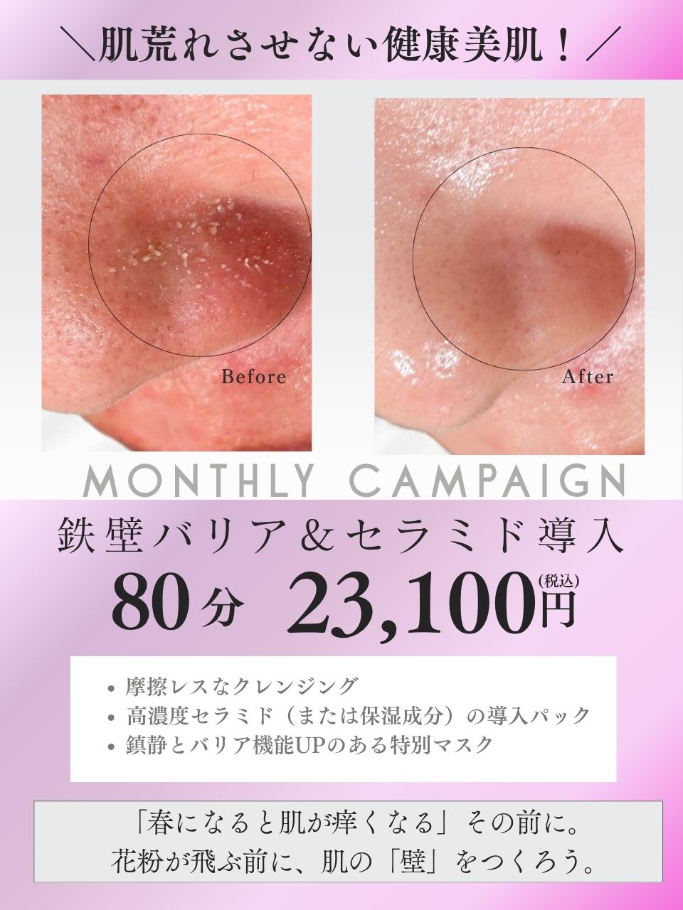 下北沢フェイシャル